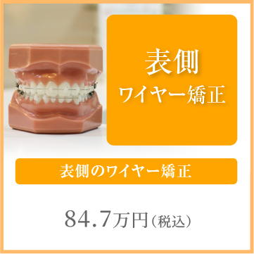 表側のワイヤー矯正