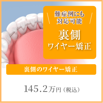 裏側のワイヤー矯正